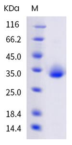 SARS-CoV-2 Spike Protein (RBD) (B.1.630) His-tag Protein