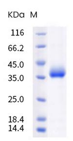 SARS-CoV-2 Spike Protein (RBD) (B.1.617.2) His-tag Protein