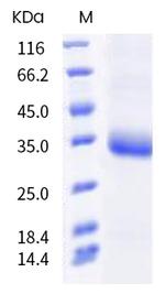 SARS-CoV-2 Spike Protein (RBD) (N440D) His-tag Protein