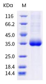 SARS-CoV-2 Spike Protein (RBD) (N481K) His-tag Protein