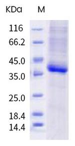 SARS-CoV-2 Spike Protein (RBD) (N487D) His-tag Protein