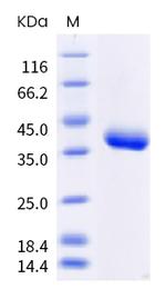 SARS-CoV-2 Spike Protein (RBD) (N501Y) His-Avi Tag Protein