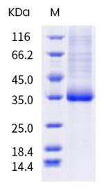 SARS-CoV-2 Spike Protein (RBD) (P479H) His-tag Protein