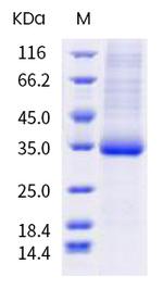 SARS-CoV-2 Spike Protein (RBD) (P479L) His-tag Protein