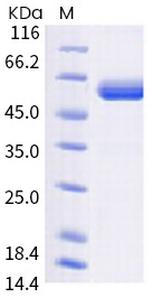 SARS-CoV-2 Spike Protein (RBD) (B.1.6221) Fc Chimera Protein