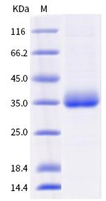 SARS-CoV-2 Spike Protein (RBD) (B.1.621) His-tag Protein