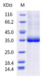 SARS-CoV-2 Spike Protein (RBD) (S477G) His-tag Protein