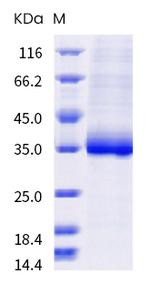 SARS-CoV-2 Spike Protein (RBD) (T478K) His-tag Protein