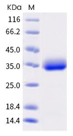 SARS-CoV-2 Spike Protein (RBD) (C.1.2) His-tag Protein