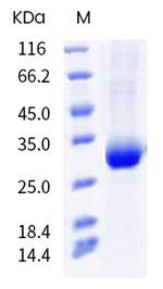 SARS-CoV-2 Spike Protein (RBD) (Y473F) His-tag Protein