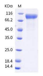 SARS-CoV-2 Spike Protein S1 (B.1.1.7) His-Avi Tag Protein