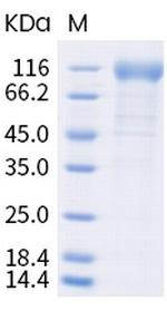 SARS-CoV-2 Spike Protein S1 (B.1.617) His-tag Protein