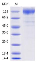 SARS-CoV-2 Spike Protein S1 (P.2) His-tag Protein