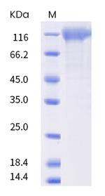 SARS-CoV-2 Spike Protein S1 (C.37) His-tag Protein