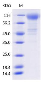 SARS-CoV-2 Spike Protein S1 (C.37) His-tag Protein