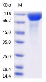 SARS-CoV-2 Spike Protein S1 (P.1) His-Avi Tag Protein