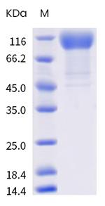 SARS-CoV-2 Spike Protein S1 (B.1.427) His-tag Protein