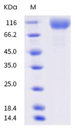 SARS-CoV-2 Spike Protein S1 (B.1.526) His-tag Protein