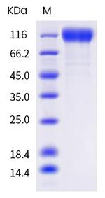 SARS-CoV-2 Spike Protein S1 (C.1.2) His-tag Protein