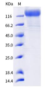 SARS-CoV-2 Spike Protein S1 (AY.3) His-tag Protein