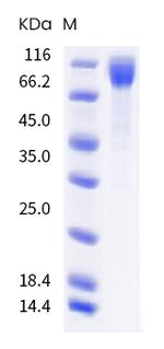 SARS-CoV-2 Spike Protein S1 (B.1.617.2) His-tag Protein