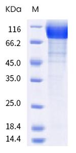 SARS-CoV-2 Spike Protein S1 (B.1.617.3) His-tag Protein