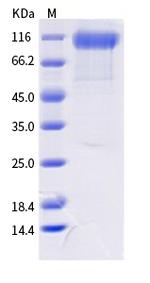 SARS-CoV-2 Spike Protein S1 (AY.1) His-tag Protein