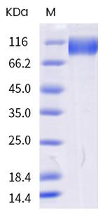 SARS-CoV-2 Spike Protein S1 (AY.4) His-tag Protein