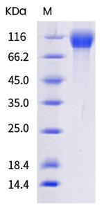 SARS-CoV-2 Spike Protein S1 (AY.4.2) His-tag Protein