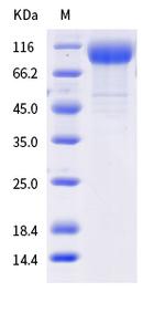 SARS-CoV-2 Spike Protein S1 (AY.2) His-tag Protein
