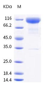 SARS-CoV-2 Spike Protein S1 (B.1.617.1) His-Avi Tag Protein