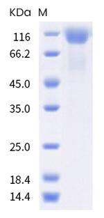 SARS-CoV-2 Spike Protein S1 (B.617.1) His-tag Protein