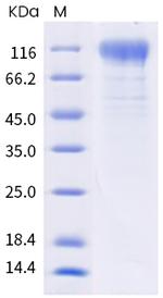 SARS-CoV-2 Spike Protein S1 (B.1.621) His-tag Protein