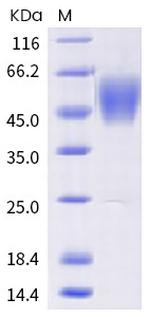 SARS-CoV-2 Spike Protein S1 (mutant) His-tag Protein