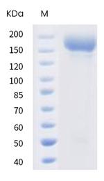 SARS-CoV-2 Spike Protein S1/S2 (D614G) His-tag, trimer Protein