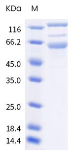 SARS-CoV-2 Spike Protein S1/S2 (B.1.617) His-tag Protein