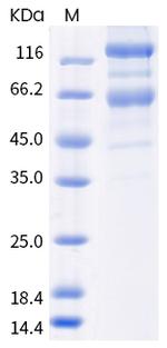 SARS-CoV-2 Spike Protein S1/S2 (B.1.351) His-tag Protein