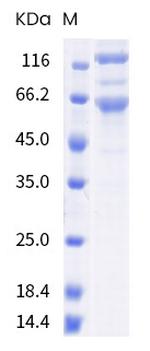SARS-CoV-2 Spike Protein S1/S2 (B.1.617) His-tag Protein