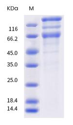SARS-CoV-2 Spike Protein S1/S2 (P.2) His-tag Protein