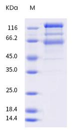 SARS-CoV-2 Spike Protein S1/S2 (C.37) His-tag Protein