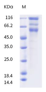 SARS-CoV-2 Spike Protein S1/S2 (B.1.526) His-tag Protein