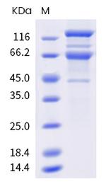 SARS-CoV-2 Spike Protein S1/S2 (B.1.351) His-Avi Tag Protein