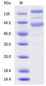 SARS-CoV-2 Spike Protein S1/S2 (B.1.620) His-tag Protein