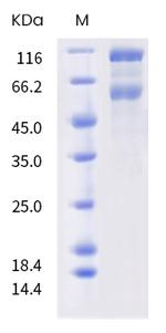 SARS-CoV-2 Spike Protein S1/S2 (B.1.525) His-tag Protein