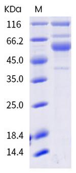SARS-CoV-2 Spike Protein S1/S2 (AY.3; AY.4) His-tag Protein