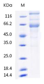 SARS-CoV-2 Spike Protein S1/S2 (B.1.617.2) His-tag Protein