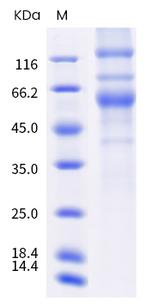 SARS-CoV-2 Spike Protein S1/S2 (mutant) His-tag Protein