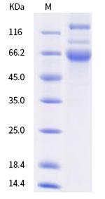 SARS-CoV-2 Spike Protein S1/S2 (AY.2) His-tag Protein