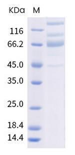 SARS-CoV-2 Spike Protein S1/S2 (mutant) His-Avi Tag Protein