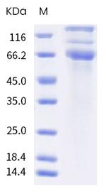 SARS-CoV-2 Spike Protein S1/S2 (B.1.617.1) His-tag Protein